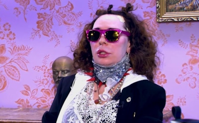 Жанна Агузарова напугала лицом после пластических операций