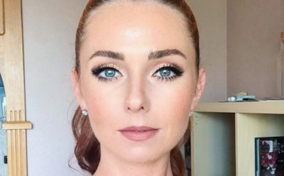 Лена Катина рассказала о синяках из-за участия в шоу «Маска»