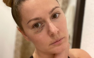 Кожевникова опровергла слухи об избиении