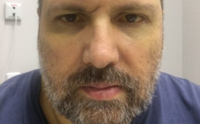 Музыкант Алексей Румянцев готовится к операции