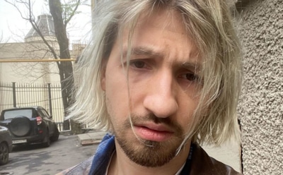 «Огромные синяки»: Мильковский из «Нервов» показал фото на паспорт