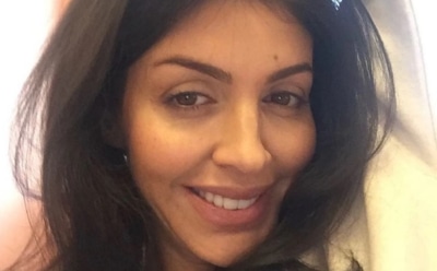 Экс-жена Андрея Аршавина Алиса Казьмина уменьшила свой нос