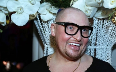 7 звезд, которые лишились зубов