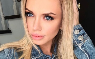 Милана Тюльпанова сделала новую пластическую операцию