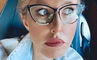 У Ксении Собчак заметили признаки лишая