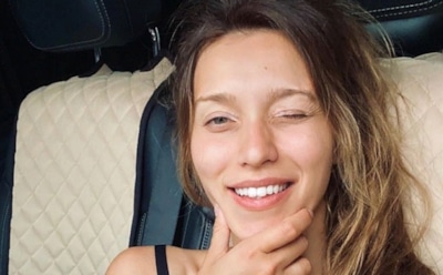 Партнер Тодоренко по «Ледниковому периоду» получил из-за нее травму