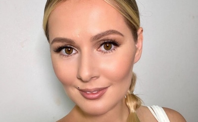 Кожевникова рассказала, как выбила передние зубы