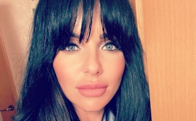 Юлия Волкова вспомнила, как «нерусский мужчина» сломал ей челюсть