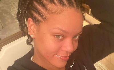 Певица Рианна ушибла лицо, упав с электросамоката