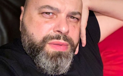 Фадеев упал с самоката и получил серьезные травмы