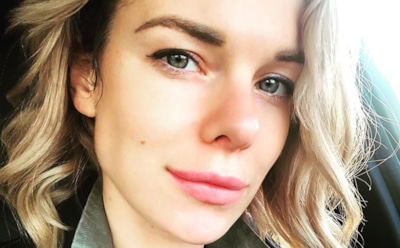 Звезда сериала «Психологини» Анна Старшенбаум призналась в пластике