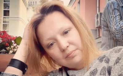 Внучка Гурченко получила травму челюсти после драки с моделью