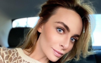 Варнаву раскритиковали из-за «комков» в губах