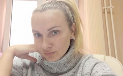 Появились фото отсидевшей Дашко до и после пластики