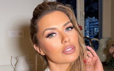 Дочке Виктории Бони в школе сожгли руки антисептиком