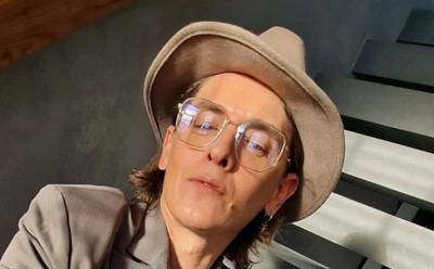 Влад Лисовец объяснил моду на волосатые родинки