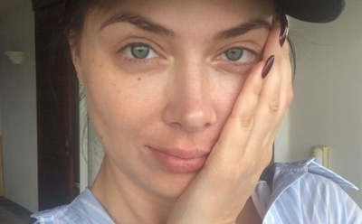 У Самбурской из-за болезни начали выпадать волосы