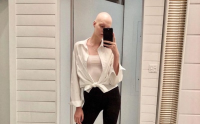 В шоу «Ты - топ-модель» взяли девушку с алопецией