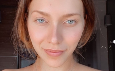 У Регины Тодоренко нашли «болезнь Майкла Джексона»