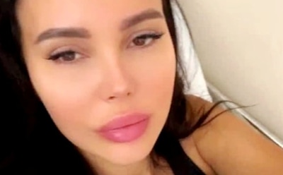 Оксана Самойлова повторно увеличила бюст