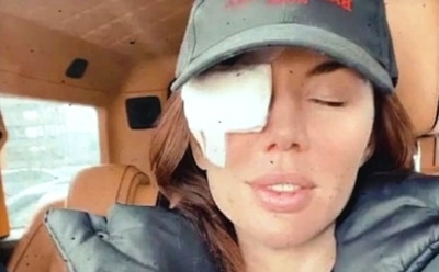 Анна Седокова перенесла экстренную операцию