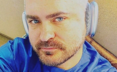 Избранник Надежды Бабкиной сделал пересадку волос