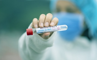 Роспотребнадзор: штамм «дельта» в три раза заразнее обычного