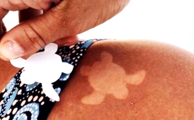 Дерматолог рассказал об опасности «солнечных татуировок»