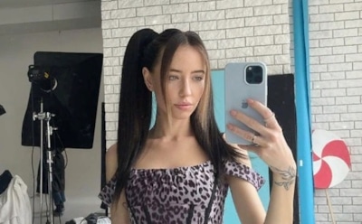 «Сделали трепанацию»: Надя Дорофеева сообщила об избиении своего танцора