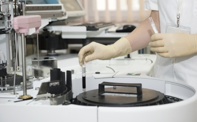 Эпидемиолог назвала срок наступления постковидного синдрома