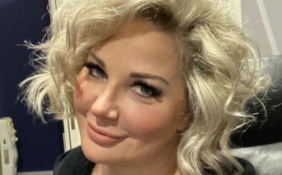 Максакова призналась, что начала лысеть после убийства мужа