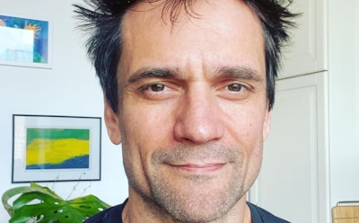 Актер Дмитрий Миллер оказался на костылях