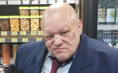 Стас Барецкий заявил, что его избили фанаты певицы МакSим