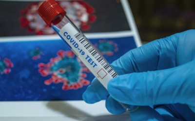 У COVID-19 изменились главные симптомы – Роспотребнадзор