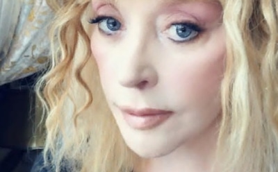 Врач обнаружил у Пугачевой «вдовий горбик»