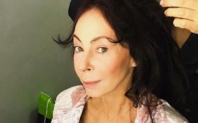 Продюсер рассказал, что стало с лицом обгоревшей в пожаре Хлебниковой