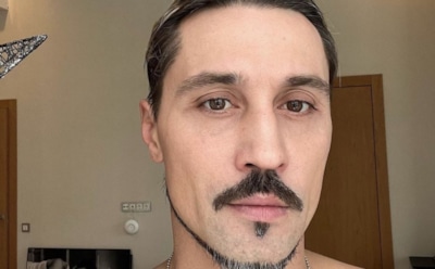 «Давно планировал»: Дима Билан готовится к операции