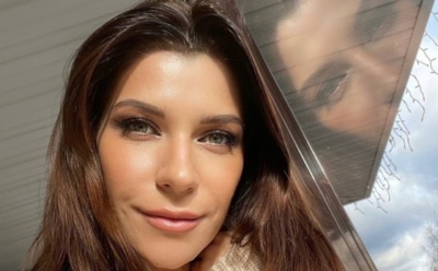 Екатерина Волкова пожаловалась на отеки после операции