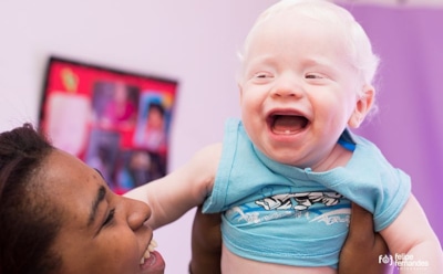 Альбинизм: описание и формы болезни, причины возникновения, история изучения, День альбиноса