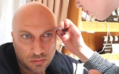 Дмитрий Нагиев пострадал после падения декораций