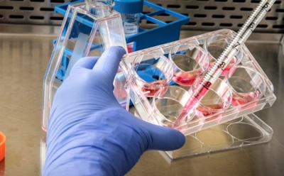 В России зарегистрировали первый случай оспы обезьян