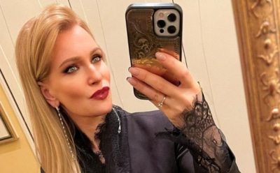 Олеся Судзиловская рассказала о борьбе со старением при помощи оленьих рогов