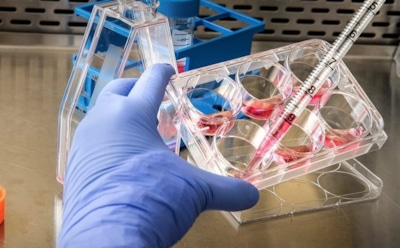 Оспой обезьян впервые заразилась женщина