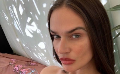 У Водонаевой появились проблемы с кожей после участия в «Звездах в Африке»