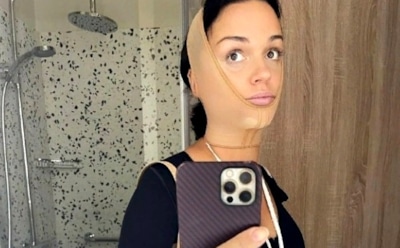 Певица Слава сделала липосакцию за 3 млн рублей