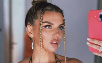 Анна Седокова страдает из-за приступов крапивницы