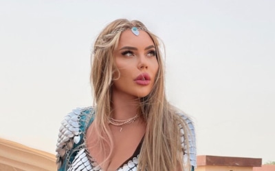 Карина Кросс рассказала о травме ноги после ухода из шоу «Маска. Танцы»