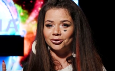 Бьянка рассказала о болезни, из-за которой внезапно опухла