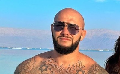 Джиган объяснил появление синяка под глазом