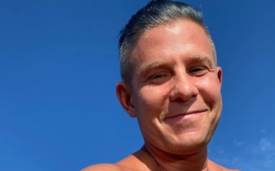 Митя Фомин признался в использовании ботокса